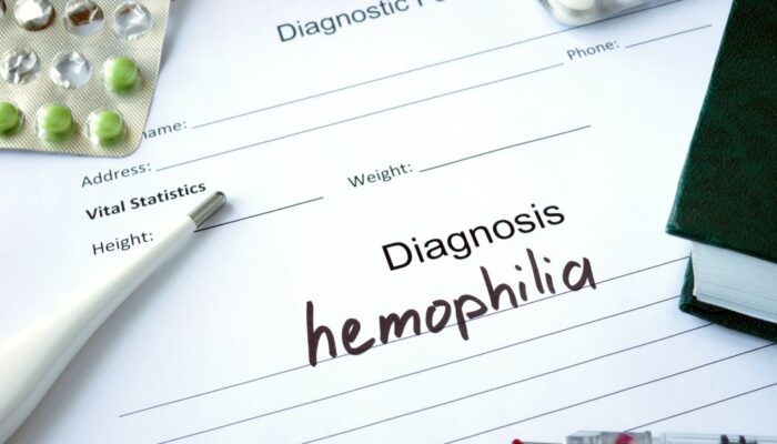 Here’s what to eat for hemophilia