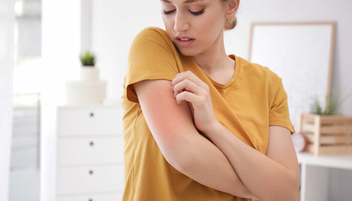 Allergies – Stages and prevention