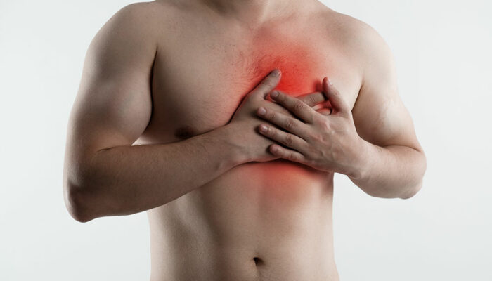 Stages, diagnosis, and prevention of heartburn